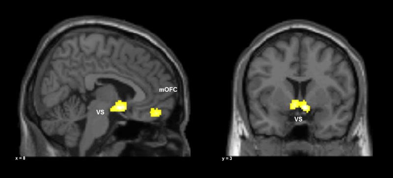 MRT-Aufnahmen des menschlichen Gehirns
