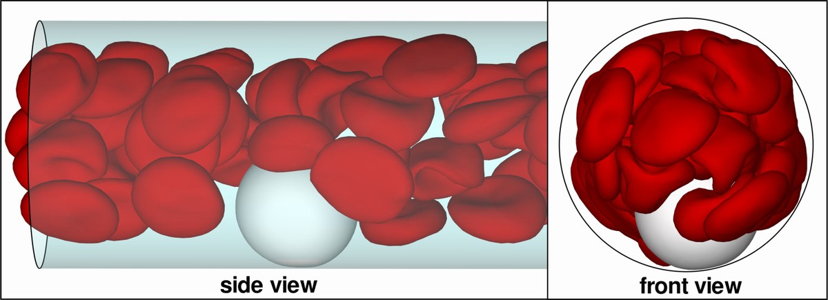 Simulationsbild: Ein weißes Blutkörperchen wird an den Rand der Kapillare gedrängt.
