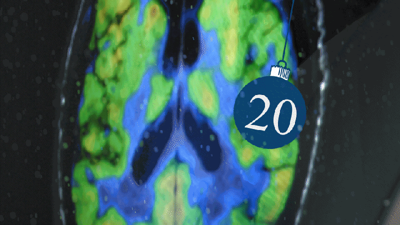 Ein Medikament gegen Alzheimer entwickeln