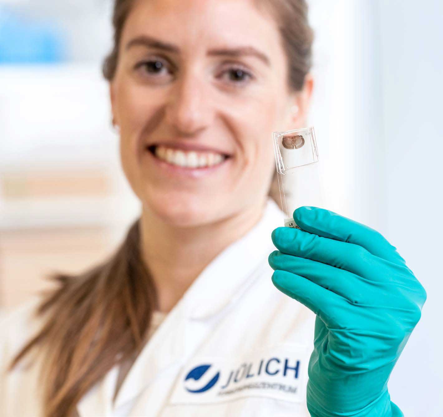 Anika Kuckertz mit dem Hirnschnitt einer Ratte.