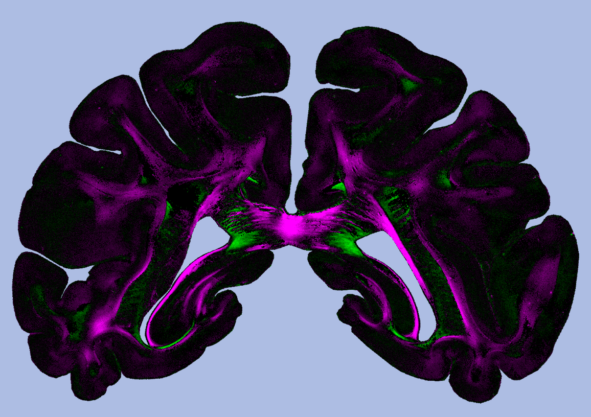 „Diattenuation Imaging“ (DI)
