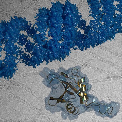 Helikale Struktur des Autophagie-Rezeptors p62/SQSMT1 (blau) bei atomarer Auflösung und isolierte p62-Momomer-Einheit (goldfarben) vor einer kryoelektronenmikroskopischen Aufnahme.