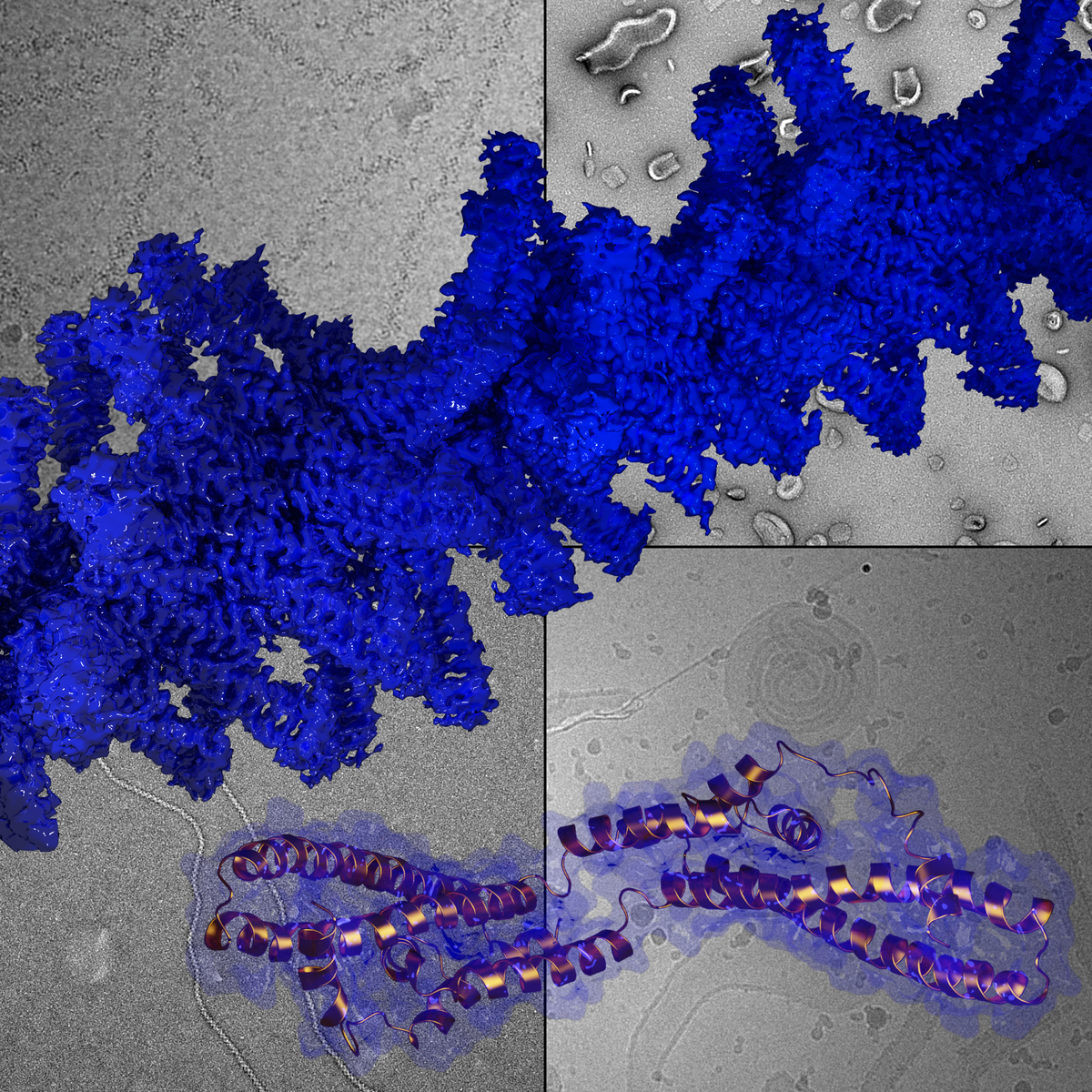 Struktur eines doppelsträngigen ESCRT-III-Polymers (blau) und der isolierten Tetramer-Einheit (gold). Im Hintergrund zeigen vier elektronmikroskopische Aufnahmen die Membranverformung im Reagenzglas.