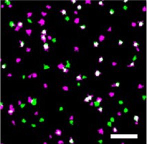 Hochauflösende Mikroskopie zur Analyse von Proteinkomplexen