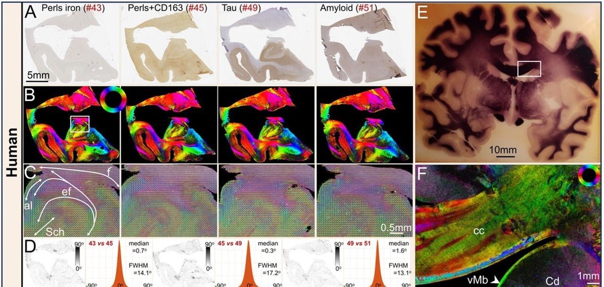 Mikroskopische Gehirnkarte: ComSLI macht Netz von Nervenfasern in unterschiedlich präparierten Gewebeschnitten sichtbar