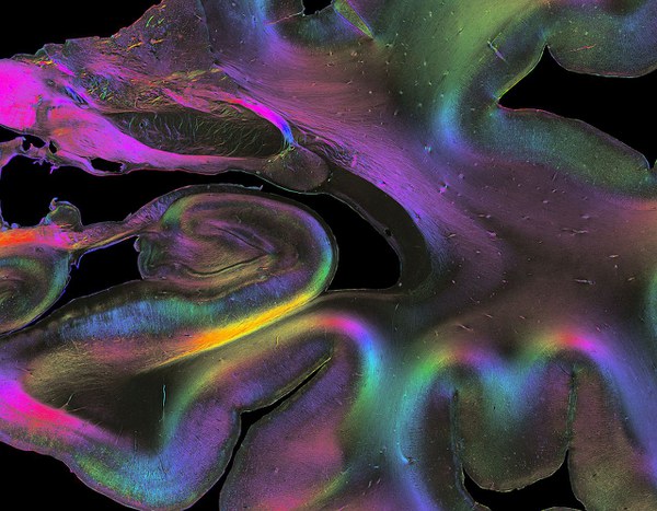 Die Entschlüsselung verschachtelter neuronaler Netzwerke des Gehirns