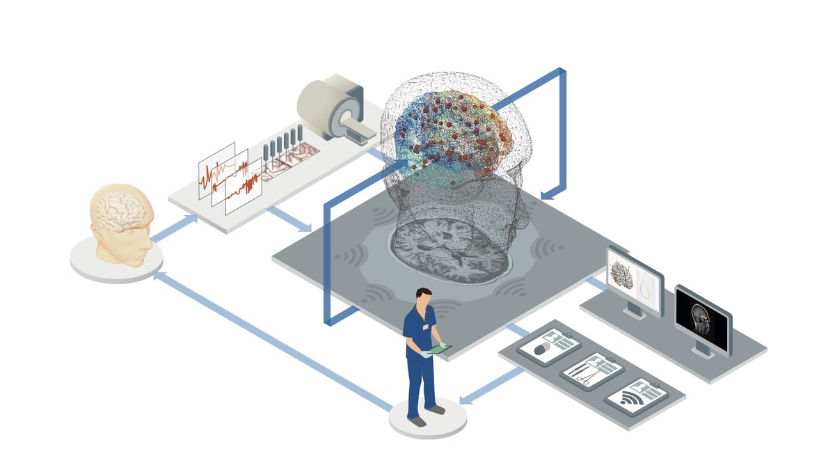 Neues EBRAINS-Projekt entwickelt personalisierte Hirnmodelle für die psychiatrische Forschung