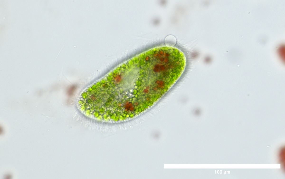 Pantoffeltierchen trifft Cyanobakterium: Wie aus zwei eins wird