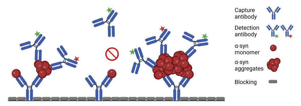 Hinweis auf Parkinson-Vorform in Stuhlprobe