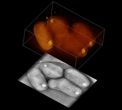 14-02-18Agrobacterium-tumefaciens.poster.jpeg