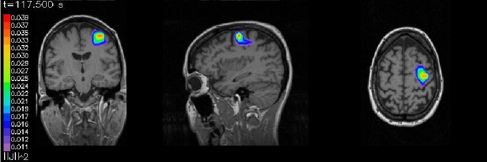 2003-15-parkinson-klein_jpg