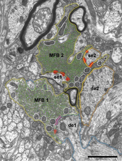522_PREV_Synapse2_jpg