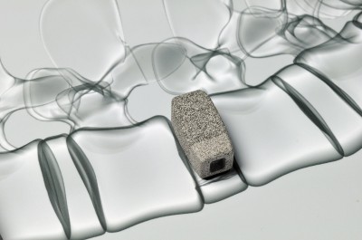 729_PREV_wirbelsaeulenimplantat_03_jpg