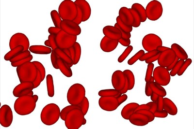 Rote Blutkörperchen
