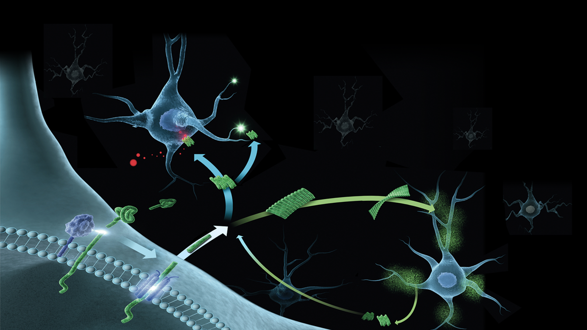 Verlaufsdarstellung der Bildung und Aggregation des Amyloid-beta-Proteins