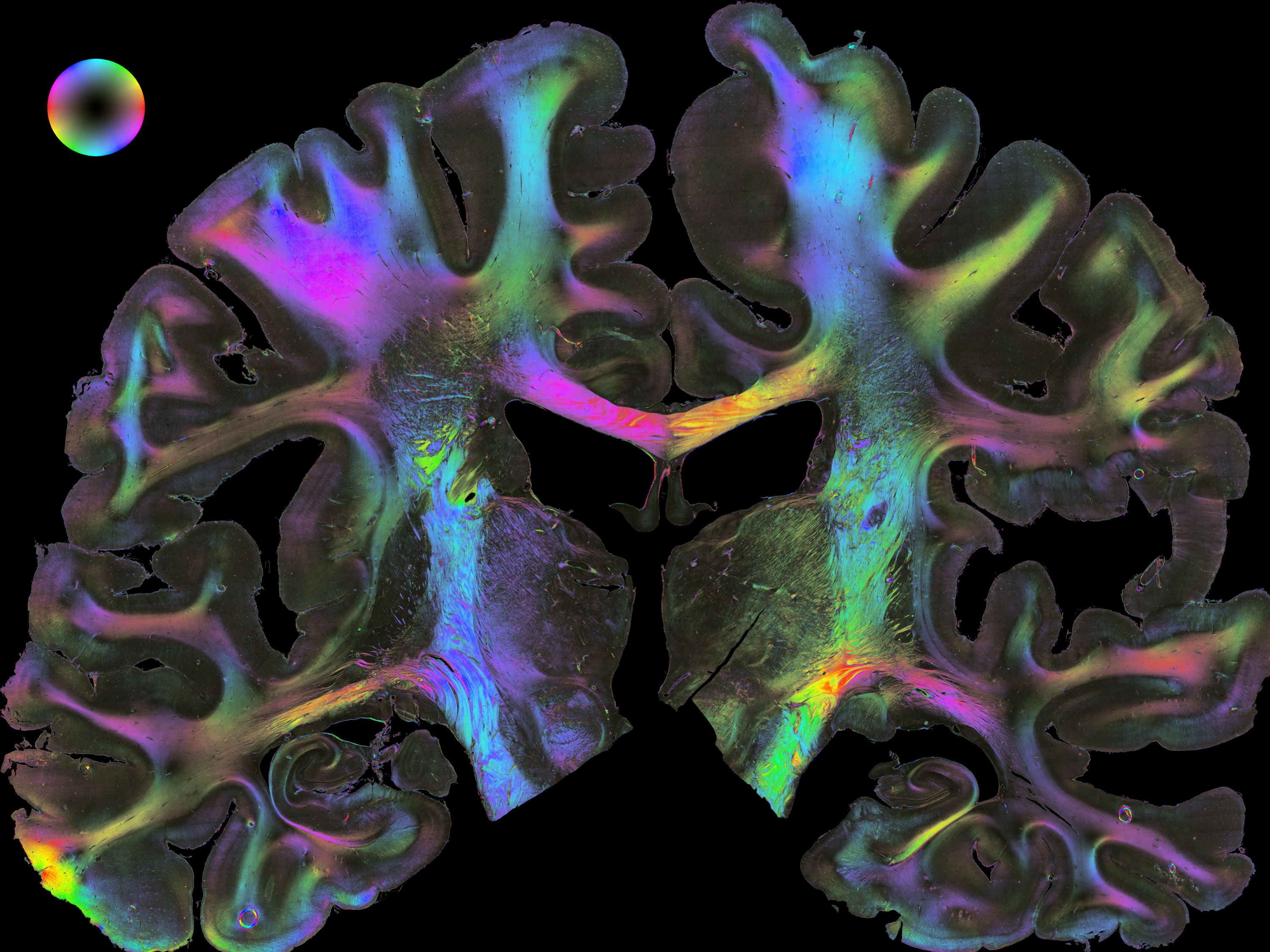 Polarized Light imaging: Nervenfaserbahnen