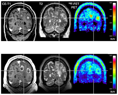 2020-10-08-fet-pet-fig2-450.poster.png