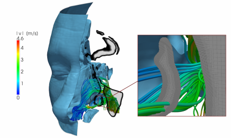 Inspiratory flow in the human nasal cavity.