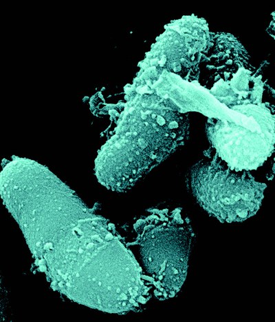 Graphic of Discovery of the Missing Link in Corynebacterial Cell Wall Biosynthesis