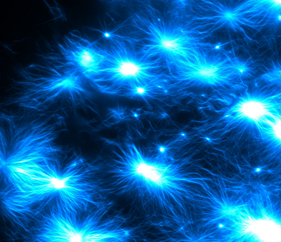 Parkinson-Fibrillen.poster.png