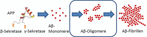 Alzheimersche Demenz