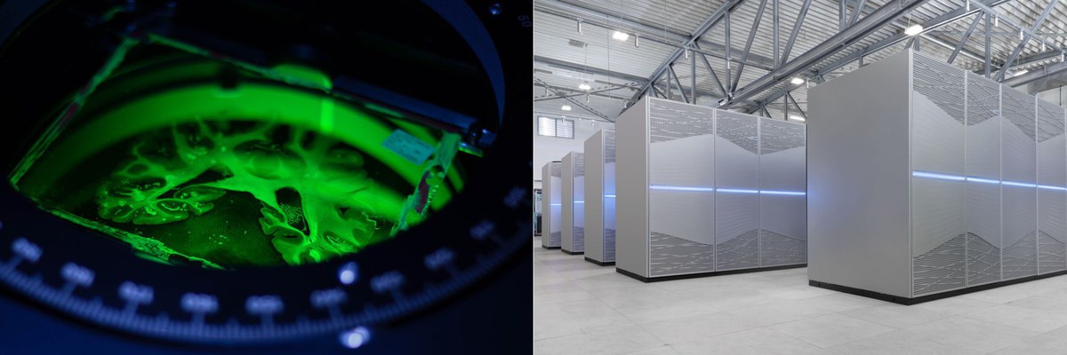 Brain Fibre Measurement and Supercomputer Juwels