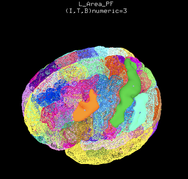 Jülich Brain Atlas wird neuer Default-Atlas in AFNI