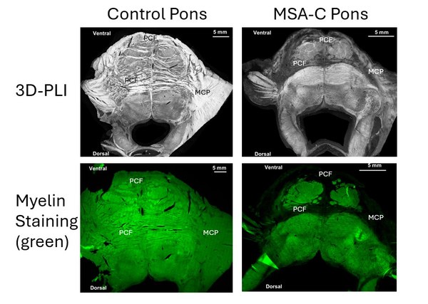 Posterpreis für Denise Kalbe