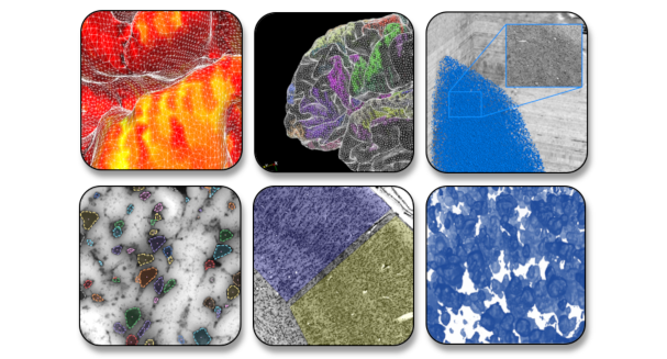 Biomedical image analysis