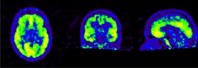 Studienteilnahme_Probanden gesucht.jpg