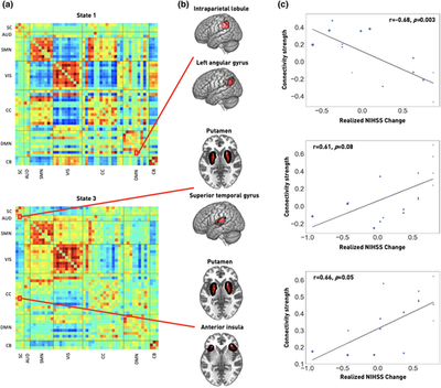 Abnormal dynamic functional connectivity is linked to recovery after acute ischemic stroke