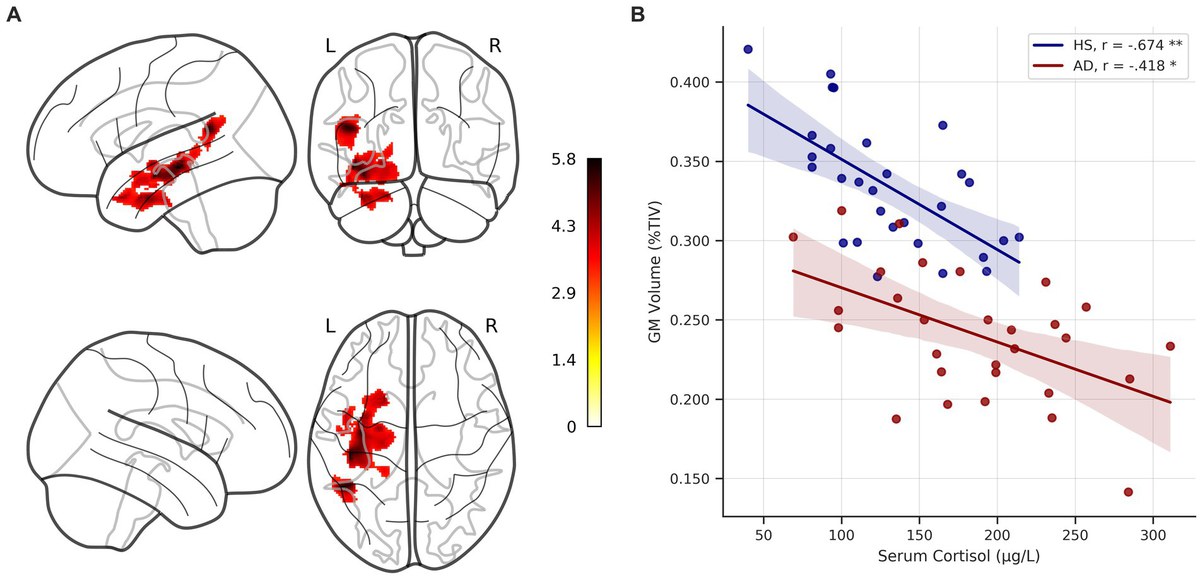 Serum cortisol is negatively related to hippocampal volume, brain structure, and memory performance in healthy aging and Alzheimer’s disease