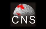cns_160_100.poster.jpeg