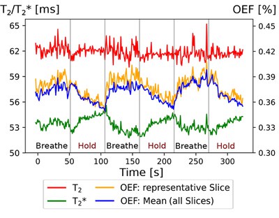 Entwicklung einer neuen Methode zur Messung der Sauerstoffextraktionsfraktion