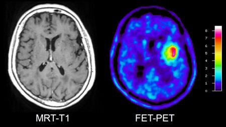 FET-PET