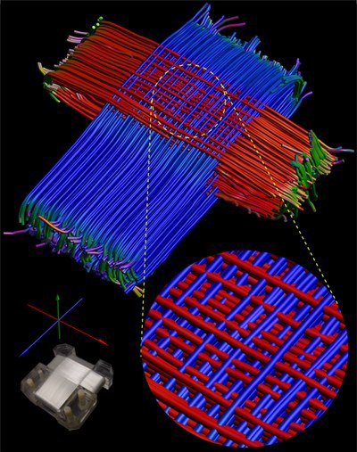 Entwicklung von Phantomen zur Untersuchung der anisotropen Diffusion im Gehirn