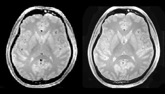 Entwicklung und Anwendung von ultrahochauflösende Relaxationszeit und Wassergehaltsmessungen