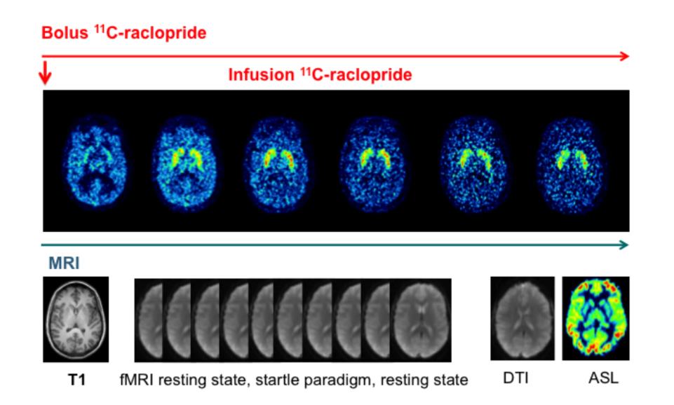 Eine genetische, simultane MR-PET-EEG/EMG-Studie zu den Effekten von Nikotin auf die frühe Aufmerksamkeitsverarbeitung bei Rauchern und Nichtrauchern