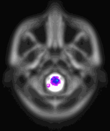 Multimodale Bildgebung