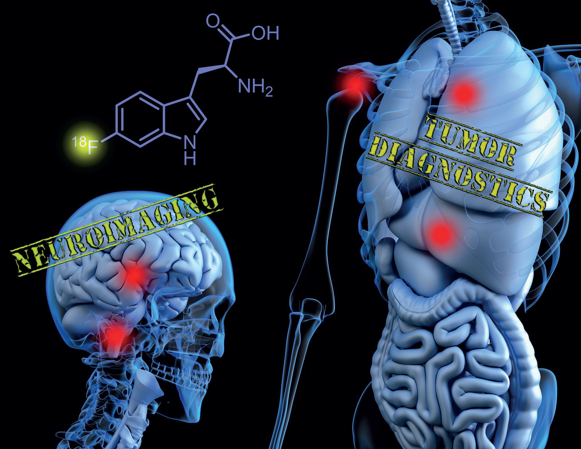7-%5B18F%5D-Fluorotryptophan.poster.jpeg