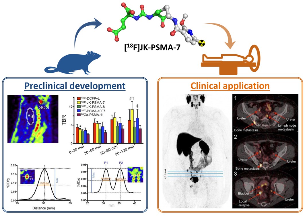 Entdeckung von [18F]JK-PSMA-7 als neuer PET-Tracer zum Nachweis kleiner PSMA-positiver Läsionen