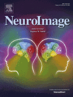 Entdeckung von 7-[18F]Fluortryptophan als neuer PET-Tracer zur Visualisierung des Tryptophanstoffwechsels