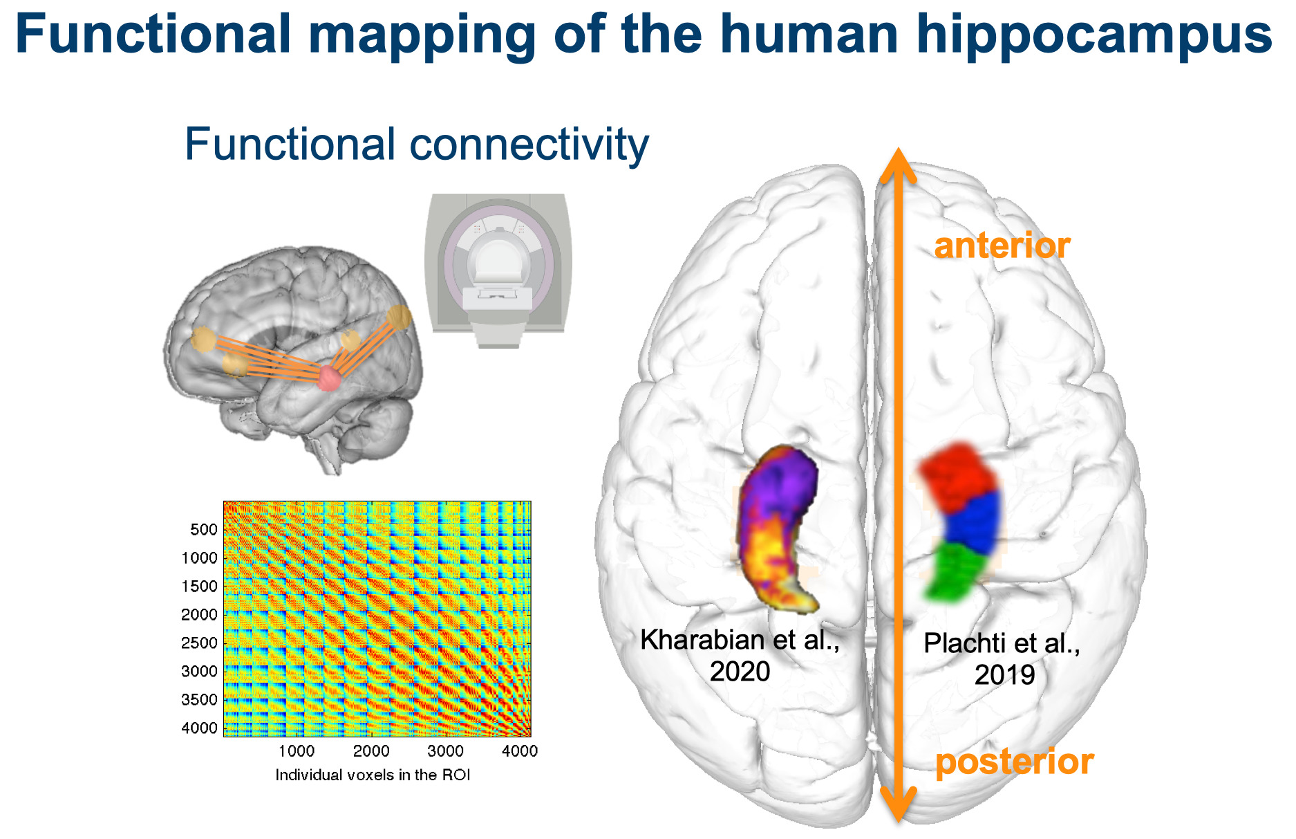 Kartierung von Struktur und Funktion des Hippocampus durch das Cognitive NeuroInformatics Lab