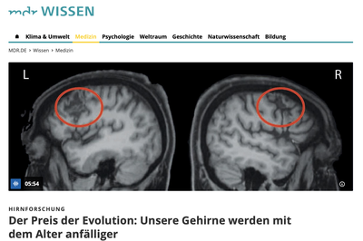 Der Preis der Evolution: Unsere Gehirne werden mit dem Alter anfälliger