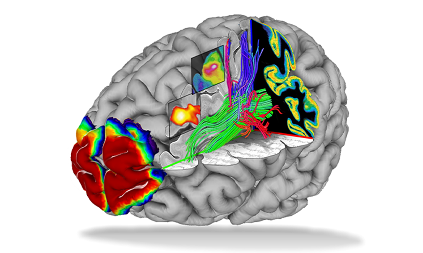Institut für Neurowissenschaften und Medizin (INM)