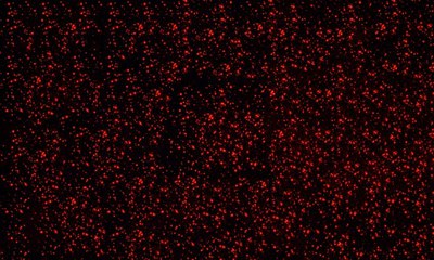 sFIDA – single particle analysis for CNS diagnostics