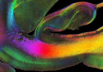 Fortbildung "Faszination Gehirnforschung"