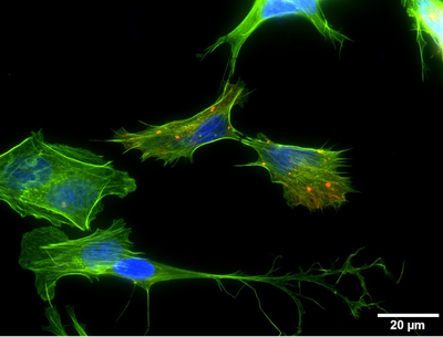 IBI Seminar: Investigating mental illnesses as protein aggregation disorders
