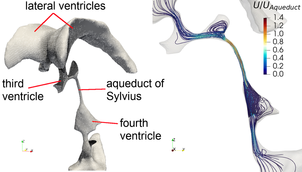 Project CSF-Dyn - DNS of Cerebrospinal Fluid Dynamics