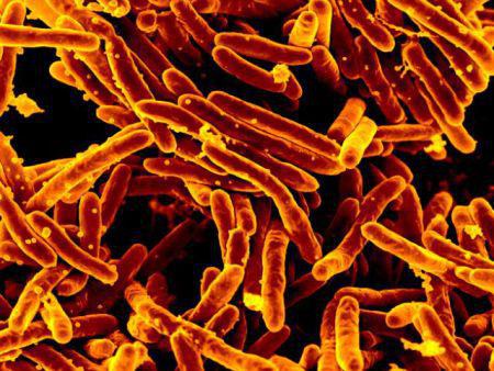 Image of agent of tuberculosis